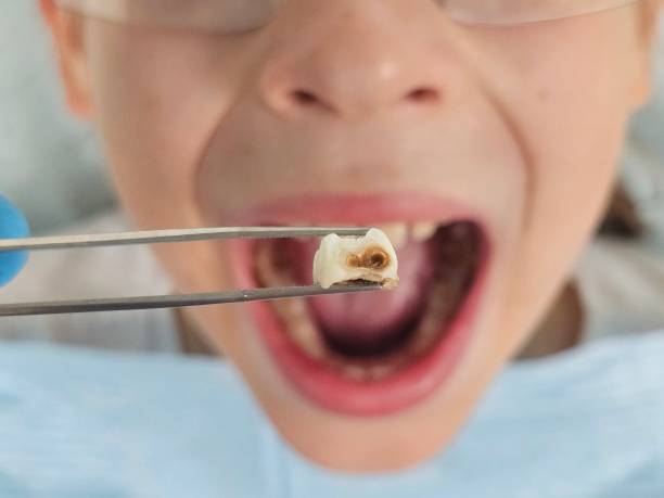 Best Pediatric Emergency Dentist in Coal City, WV
